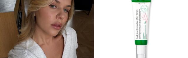 Borite se sa hiperpigmentacijom? Vreme je da uvedete ovaj viralni serum u „beauty“ rotaciju