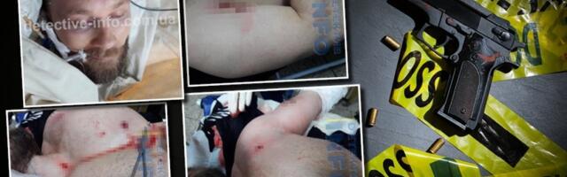 Radoje Zvicer u zavojima, sav krvav: Pokušaj atentata na vođu kavčana (FOTO)