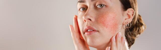 Lice otkriva bolest jetre: 5 alarmantnih simptoma koje ne smete da ignorišete