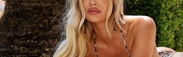 SOFIJU MILOŠEVIĆ NAPALI NA DRUŠTVENIM MREŽAMA ZBOG BOTOKSA NA LICU! Influenserka na udaru zbog lepote