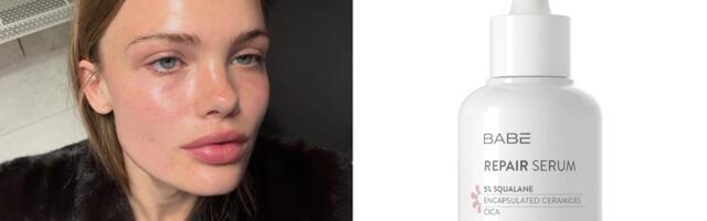 6 seruma sa skvalanom kojima smo trenutno opsednuti