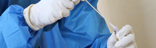 AFP: U svetu od korone umrlo 1.081.902 ljudi