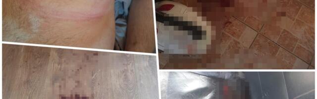 "SNIMAM OVAJ VIDEO DA POKAŽEM KOLIKO SAM OPASNA PO SEBE I PO DRUGE" Nožem izbola momka (22), pa sve zabeležila kamerom! On tvrdi: Borio sam se za život (foto)