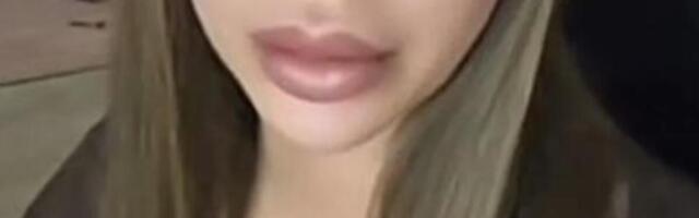 MILJO, TI LI SI? KULIĆKA SNIMILA KAKO IZGLEDA POSLE PRIMANJA TERAPIJE! Prekršila 1 stvar - lekari će da polude