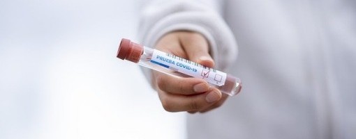 U Severnu Makedoniju građani Srbije i još tri zemlje regiona od sutra bez PCR testa