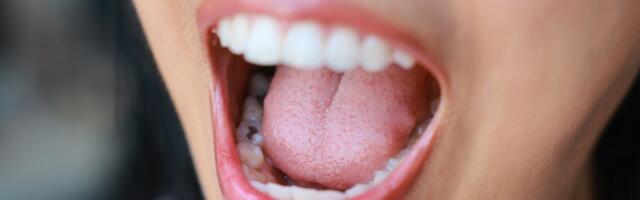 Ako na jeziku primetite ove promene, morate hitno nadoknaditi važan vitamin: Postoje i najrizičnije grupe judi