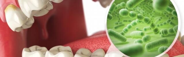 Lečenje zubne infekcije može popraviti nivo šećera u krvi i zdravlje srca