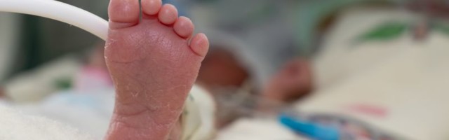 Imao je rupu na srcu i krvarenje u mozgu: Priča o čudesnoj bebi koja je preživela nemoguće