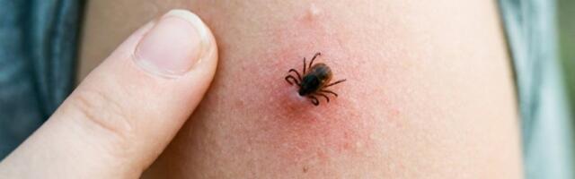 Greška koju mnogi prave kad vade krpelja: Lekari otkrili šta nikako ne smete da radite