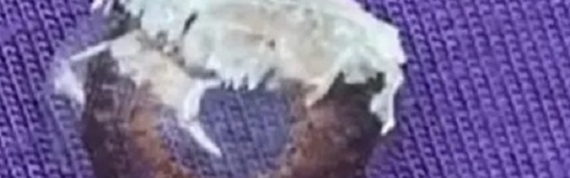 Žena je svojom nesvesnom greškom umalo ostala bez vida: Naime sipala je sama sebi lepak u oko nakon čega je zavladala panika i haos!