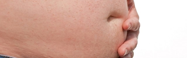 Britanci bi mogli da "zatvore" gojazne ljude u slučaju drugog talasa korone