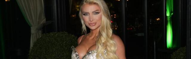 Lice crveno i u ožiljcima: Milica Kemez zabrinula objavom (VIDEO)