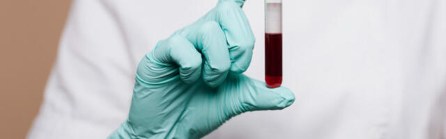 Британци раде на тесту крви који би могао да предвиди болести и до 10 година унапред