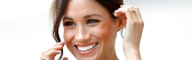 Kozmetolog Megan Markl otkriva recept njene domaće maske za lice