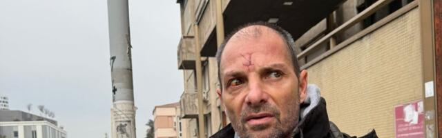 (PAPARACO) SIN SNEŽANE ĐURIŠIĆ IZAŠAO IZ BOLNICE POSLE STRAVIČNOG PREBIJANJA: Na čelu posekotina, oči krvave, pogled prazan - Prve fotografije