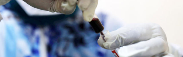 “OTKRIĆE OBEĆAVA”: Vakcina moguća do kraja godine, potrebne tri stvari