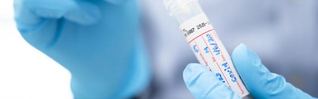 U Crnoj Gori 375 nova slučaja korone