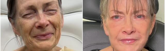 Da li verujete da je ovo ista osoba? Plastični hirurg joj promenio lični opis, ljudi u neverici gledaju slike