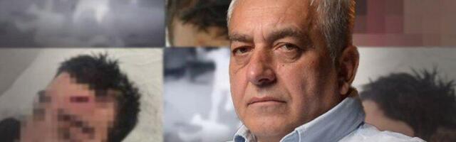 IMAO JE HEMATOME PO TELU, 14 KOPČI SAMO NA GLAVI! Otac prebijenog dečaka (14) iz Pančeva otkrio kako su se nasilnici iživljavali nad njegovim sinom! (FOTO, VIDEO)