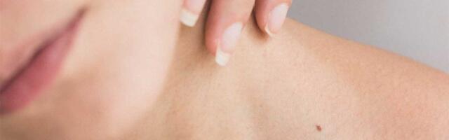 Šta je Crveni vetar i kako se leči?