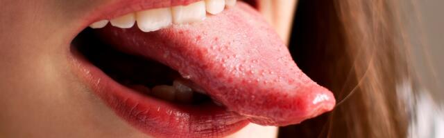 Jezik kao pokazatelj zdravlja – na šta treba da obratite pažnju