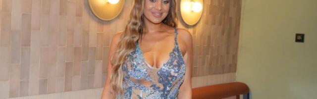 LUNA ĐOGANI UBRIZGALA BOTOKS U LICE: Evo kako sada izgleda nakon INTERVENCIJE!