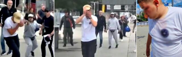 Čoveku zamalo da izbiju oko! Blokaderi potpuno "odlepili", ovako izgledaju posledice njihovog fašizma