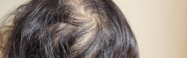 Želite gušću kosu? Ovi prirodni saveti za rast i volumen zaista rade, kažu frizeri