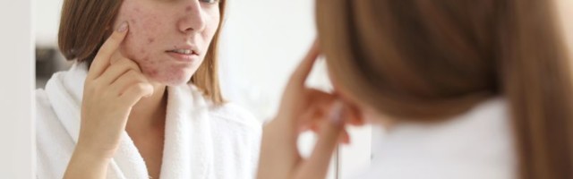 TESTOSTERON KOD ŽENA: Kakvi problemi mogu nastati i kako prepoznati simptome?