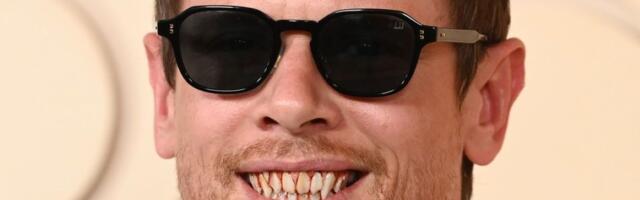 Kad se nasmejao I FOTOGRAFI SU SE NAJEŽILI! Glumac pokazao jezive zube na crvenom tepihu Oskara, mreže gore