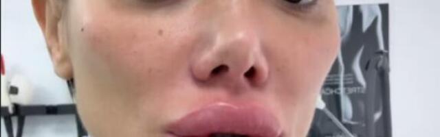 ISPUCALE USNE, SILIKONI SAMO ŠTO NE PUKNU: Tamara Đurić u SKANDALOZNOM izdanju, filterom pokušala da sakrije LICE BEZ ŠMINKE! (GALERIJA)