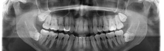 Čovek uradio rendgenski snimak zuba, stomatolozi ostali u šoku: Prizor oborio Ginisov rekord