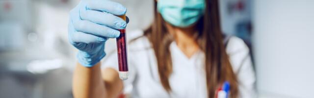 Vaše malo nekome znači mnogo: Evo gde danas možete dati krv