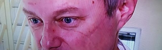 ŠOKANTNE FOTOGRAFIJE! Kada je doktor Stevanović skinuo zaštitnu opremu pred kamerama, SVI SU OSTALI U NEVERICI! (FOTO)