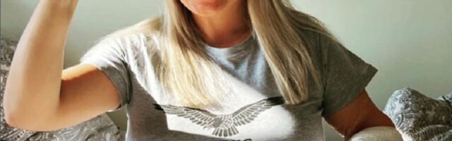 Dea Đurđević pokazala ožiljke posle 22 operacije: Evo kako izgleda njena ruka nakon skoro 6 godina od nesreće