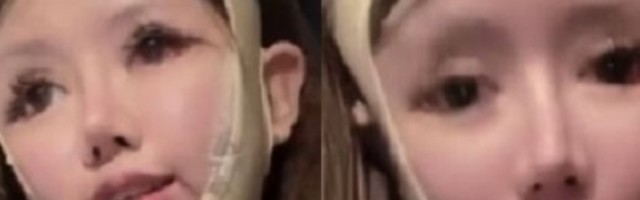 Prvu operaciju je imala sa samo 13 godina i nema nameru da stane (VIDEO)