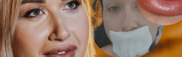 NATAŠA UPOZORAVA SRPKINJE - NE ŽELITE DA PROĐETE KAO ONA! Samo je OPERACIJOM mogla da sredi DEFORMISANA USTA