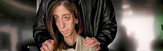 Hrabro srce: kako je "najstrašnija žena na svetu" postala idol miliona