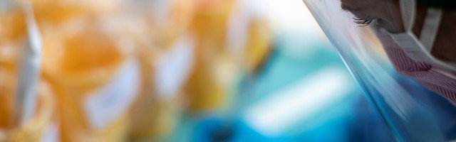 Novih 312 slučajeva, preminule još tri osobe