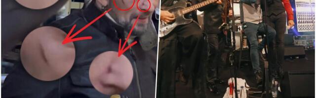 DRAMA NA KONCERTU BIJELOG DUGMETA! Muzičar iz benda pao na bini i povredio glavu: Haos na Kopaoniku, najluđa noć umalo da se završi tragično (FOTO)