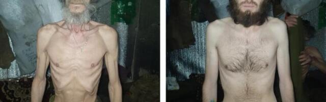 PROCURILE JEZIVE FOTOGRAFIJE UKRAJINSKIH VOJNIKA! Od prizora će vam se OKRENUTI ŽELUDAC - sama KOST I KOŽA (FOTO)