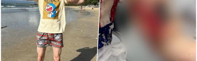 (UZNEMIRUJUĆE) POZNATOM INFLUENSERU PRETI AMPUTACIJA RUKU! Godinama ubrizgavao OPASNE supstance u bicepse kako bi izgledao SNAŽNO! (FOTO/VIDEO)