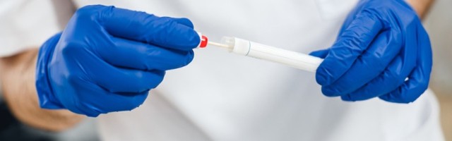 Na KiM umrlo 12 ljudi, još 462 slučaja korone