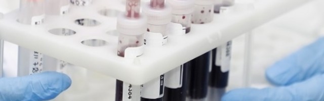 Naučnici objavili informaciju da su uspešno ukrstili gen majmuna i čoveka