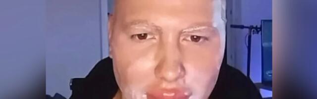"Doktori su me unakazili": Brendon izgleda kao iz zone sumraka, ali nije samo on preterao s operacijama