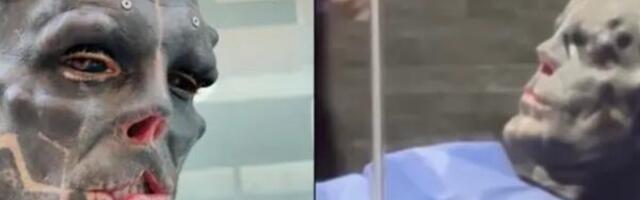 Amputirao prste kako bi se približio svojoj finalnoj formi