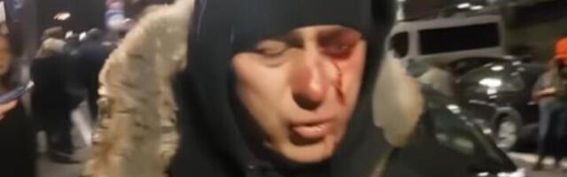 "Detektiv" Jovanov: "Neko nekog" udara u desno, a žandarm ima podliv ispod levog oka (FOTO)