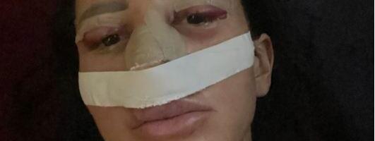 SLAĐA PORŠELINA DAJE SVE OD SEBE DA BUDE LEPA! Otišla po ko zna koji put pod iglu, evo šta je starleta sada menjala na sebi