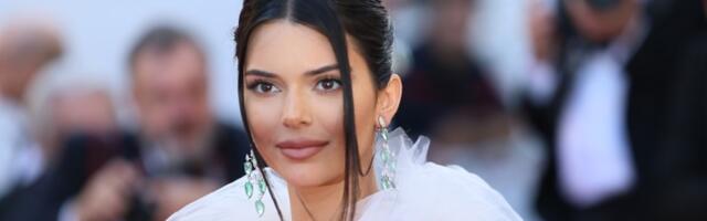 Svi misle da su je SREDILI hirurzi, a manekenka tvrdi: Nisam radila plastične operacije (VIDEO)