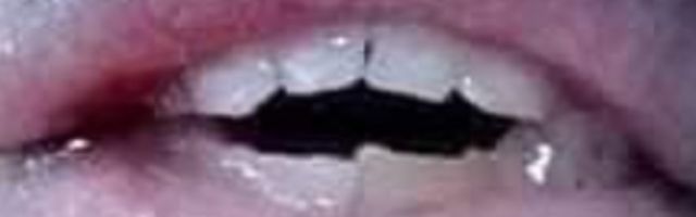 Možda ste ih i sretali izbliza u pijanom stanju, ali ne - ovo nije ljudsko biće! "Više su s*ksi od mojih", reče čovek (FOTO)